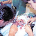 الولادة المبكرة، الطفل الخديج ( الطفل الذي يولد قبل المعد من عمر الحمل ) Premature birth – premature baby