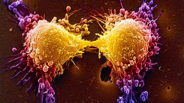 استحداث جهاز جديد للكشف عن الخلايا السرطانية